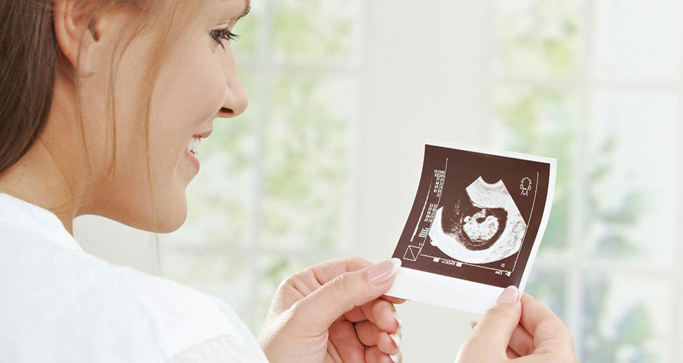 Une femme en chemise blanche tient une image échographique en noir et blanc d'un bébé.